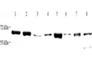 Western blot analysis of ZCCHC7 (ABIN7076279) at dilution of 1: 4000,Lane 1: HeLa cell lysate,Lane 2: K562 cell lysate,Lane 3: HL60 cell lysate,Lane 4: Mouse brain tissue lysate,Lane 5: Mouse kidney tissue lysate,Lane 6: Rat brain tissue lysate,Lane 7: Rat kidney tissue lysate,Lane 8: Rat uterus tissue lysate (ZCCHC7 抗体)