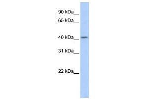 SOHLH1 antibody used at 1 ug/ml to detect target protein. (SOHLH1 抗体  (Middle Region))