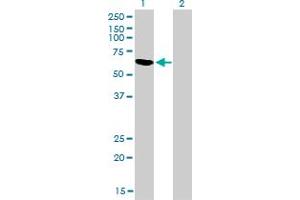 Western Blot analysis of RBM5 expression in transfected 293T cell line by RBM5 monoclonal antibody (M01), clone 2B6. (RBM5 抗体  (AA 75-184))