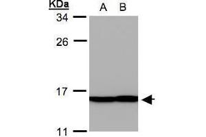 WB Image Sample(30 ug whole cell lysate) A: A431, B: H1299 12% SDS PAGE antibody diluted at 1:500 (PFN2 抗体)
