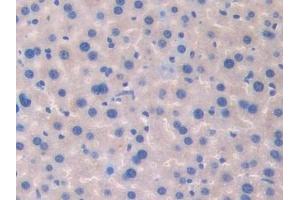 Immunohistochemistry (IHC) image for anti-Coagulation Factor V (F5) (AA 1776-2028) antibody (ABIN7438928)