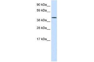 Western Blotting (WB) image for anti-SWI/SNF Related, Matrix Associated, Actin Dependent Regulator of Chromatin, Subfamily A, Member 1 (SMARCA1) (N-Term) antibody (ABIN2780089)
