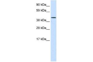 WB Suggested Anti-SMARCA1 Antibody Titration:  1.