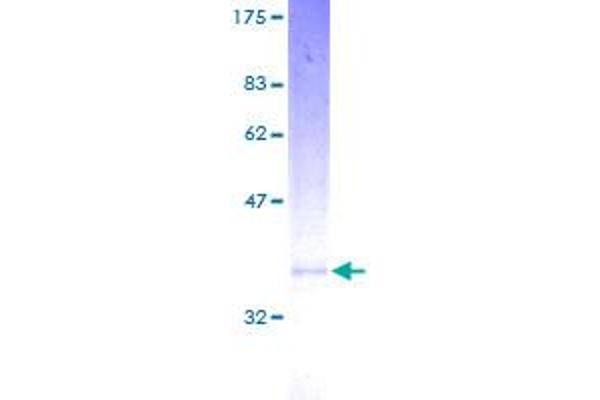 MGST3 Protein (AA 1-152) (GST tag)