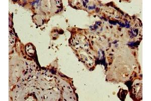 Immunohistochemistry of paraffin-embedded human placenta tissue using ABIN7146610 at dilution of 1:100 (PKIB 抗体  (AA 1-77))