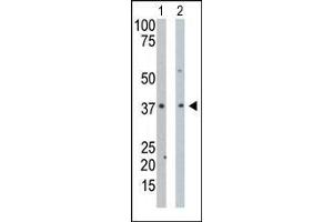 The anti-PDXK Pab is used in Western blot to detect PDXK in mouse intestine tissue lysate (Lane 1) and Hela cell lysate (Lane 2). (PDXK 抗体  (N-Term))