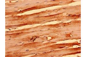 Immunohistochemistry analysis of human skeletal muscle tissue using ABIN7161366 at dilution of 1:100 (NEGR1 抗体  (AA 1-196))