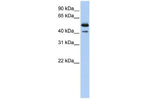 DNASE2B antibody used at 1 ug/ml to detect target protein. (DNASE2B 抗体  (Middle Region))