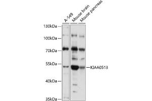 Western blot analysis of extracts of various cell lines, using KI antibody (ABIN7268113) at 1:1000 dilution. (KIAA0513 抗体  (AA 1-301))