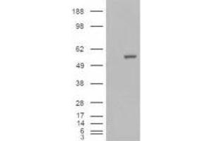 Image no. 2 for anti-Aldehyde Dehydrogenase 1 Family, Member A1 (ALDH1A1) (C-Term) antibody (ABIN374078) (ALDH1A1 抗体  (C-Term))