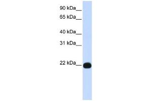 PIGA antibody used at 1 ug/ml to detect target protein.