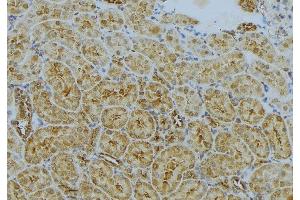 ABIN6272992 at 1/100 staining Mouse kidney tissue by IHC-P. (CLTA 抗体)