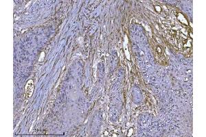 IHC analysis of Integrin linked ILK using anti-Integrin linked ILK antibody (ABIN7599410). (ILK 抗体  (AA 1-452))
