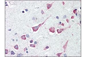 Image no. 1 for anti-Death-Associated Protein Kinase 3 (DAPK3) (Center) antibody (ABIN303252) (DAPK3 抗体  (Center))