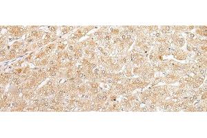 Immunohistochemistry (Paraffin-embedded Sections) (IHC (p)) image for anti-Nudix (Nucleoside Diphosphate Linked Moiety X)-Type Motif 19 (NUDT19) antibody (ABIN7248095)