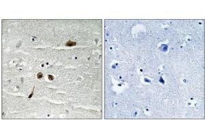 Immunohistochemical analysis of paraffin-embedded human brain tissue using MDC1 (Phospho-Ser513) antibody (left)or the same antibody preincubated with blocking peptide (right). (MDC1 抗体  (pSer513))