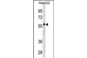 Western blot analysis in HepG2 cell line lysates (35ug/lane). (ZNF276 抗体  (AA 388-416))