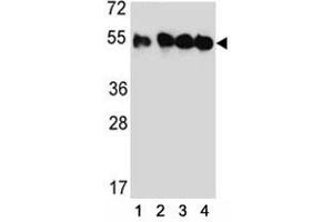 Western blot analysis of TUBB2C antibody and (1) HeLa, (2) MDA-MB435, (3) MDA-MB231, and (4) HepG2 lysate. (TUBB2C 抗体  (AA 99-125))