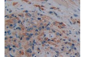 Used in DAB staining on fromalin fixed paraffin- embedded kidney tissue (Aquaporin 1 抗体  (AA 201-269))