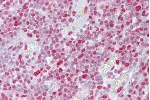 Immunohistochemistry (IHC) image for anti-H2A Histone Family, Member X (H2AFX) (Middle Region) antibody (ABIN2787620)