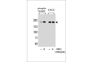 Western blot analysis of extracts from SK-BR-3 cell,untreated or treated with NRG,using phospho-mouse ERBB2-(left) or mouse ERBB2 Antibody (right). (ErbB2/Her2 抗体  (pTyr1140))