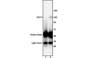 SALL4 antibody (pAb) tested by Immunoprecipitation. (SALL4 抗体  (N-Term))
