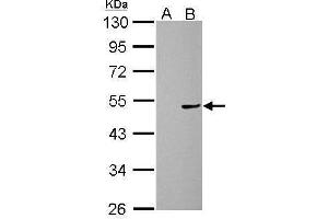 WB Image Cannabinoid Receptor 1 antibody [C1C2], Internal detects CNR1 protein by Western blot analysis. (CNR1 抗体  (C-Term))