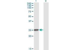 Western Blot analysis of RNF114 expression in transfected 293T cell line by ZNF313 monoclonal antibody (M03), clone S2. (RNF114 抗体  (AA 1-228))