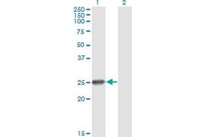 Western Blot analysis of RNF114 expression in transfected 293T cell line by ZNF313 monoclonal antibody (M03), clone S2. (RNF114 抗体  (AA 1-228))