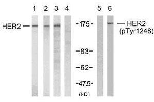 Western blot analysis using HER2 (Ab-1248) antibody (E021072, Line 1, 2, 3 and 4) and HER2 (phospho- Tyr1248) antibody (E011079, Line 5 and 6). (ErbB2/Her2 抗体)