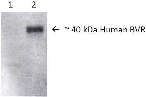 Western blot analysis of Human, Rat Brain cell lysates showing detection of BVR protein using Rabbit Anti-BVR Polyclonal Antibody . (Biliverdin Reductase 抗体  (HRP))
