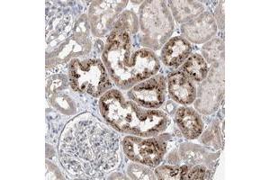 Immunohistochemical staining of human kidney with CEP85L polyclonal antibody  shows strong cytoplasmic positivity in cells of tubules at 1:10-1:20 dilution. (C6orf204 抗体)
