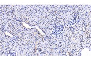 Detection of GCDH in Human Kidney Tissue using Polyclonal Antibody to Glutaryl Coenzyme A Dehydrogenase (GCDH) (GCDH 抗体  (AA 270-438))