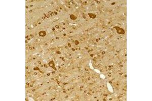 Immunohistochemical analysis of GABRG2 staining in rat brain,mouse brain formalin fixed paraffin embedded tissue section.