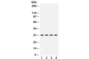 Western blot testing of 1) rat kidney, 2) rat liver, 3) human SGC and 4) human 22RV1 lysate with IGFBP3 antibody.
