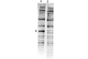 Western Blotting (WB) image for Rat Serum (Sterile) (ABIN925201) (大鼠 Serum (Sterile))