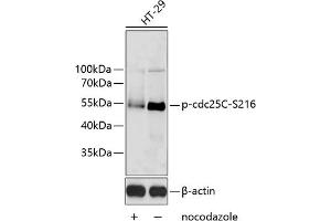 Western blot analysis of extracts of HT-29 cells, using Phospho-cdc25C-S216 antibody (ABIN6135198, ABIN6136038, ABIN6136039 and ABIN6225599). (CDC25C 抗体  (pSer216))