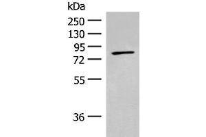 Western blot analysis of Mouse kidney tissue lysate using ADAM21 Polyclonal Antibody at dilution of 1:200