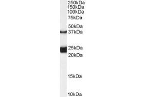 Image no. 1 for anti-Galanin Receptor 1 (GALR1) (Internal Region) antibody (ABIN374858) (Galanin Receptor 1 抗体  (Internal Region))