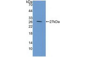 Western blot analysis of recombinant Mouse GP39. (CHI3L1 抗体  (AA 112-356))