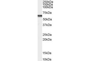 Image no. 1 for anti-Calcium Channel, Voltage-Dependent, beta 4 Subunit (CACNB4) (Internal Region) antibody (ABIN334367)