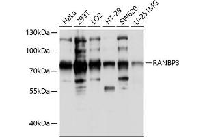 Western blot analysis of extracts of various cell lines, using R antibody (ABIN6128612, ABIN6146677, ABIN6146678 and ABIN6214044) at 1:1000 dilution.