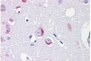 Human Brain, cortex: Formalin-Fixed, Paraffin-Embedded (FFPE) (DARS 抗体  (AA 393-501))