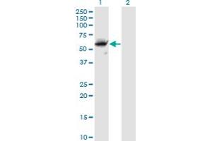 Western Blotting (WB) image for anti-CASP8 and FADD-Like Apoptosis Regulator (CFLAR) (AA 178-277) antibody (ABIN563829)
