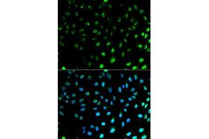 Immunofluorescence analysis of MCF7 cell using S100A8 antibody.