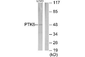 Western blot analysis of extracts from LOVO cells, using Breast Tumor Kinase antibody. (PTK6 抗体)