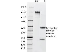 SDS-PAGE Analysis Purified BCL10 Mouse Monoclonal Antibody (SPM520). (BCL10 抗体  (AA 122-168))