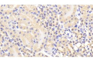 Detection of MMP1 in Mouse Kidney Tissue using Polyclonal Antibody to Matrix Metalloproteinase 1 (MMP1) (MMP1 抗体  (AA 98-275))