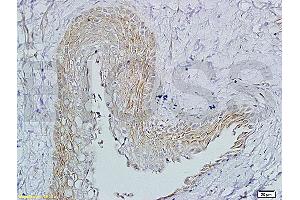 Immunohistochemistry (IHC) image for anti-Follicle Stimulating Hormone Receptor (FSHR) (AA 201-300) antibody (ABIN729508)