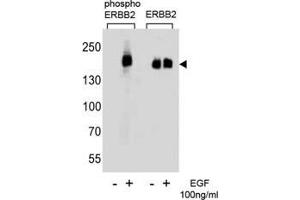 Western blot analysis of extracts from A431 cells, untreated or treated with EGF (100ng/ml), using phos-ERBB2 antibody (left) or nonphos Ab (right) (ErbB2/Her2 抗体  (pTyr1127))